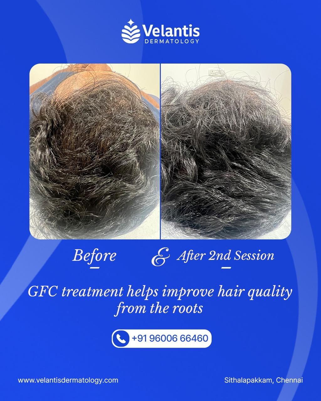 Velantis Dermatology Gallery